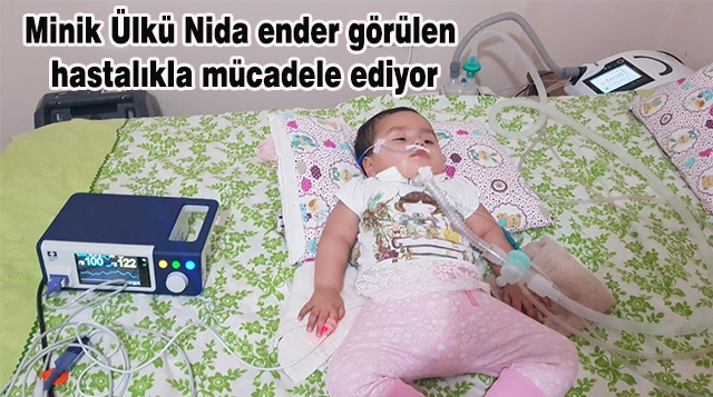 Minik Ülkü Nida ender görülen hastalıkla mücadele ediyor