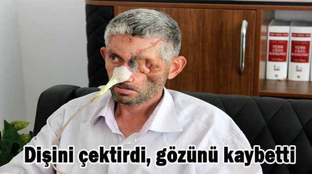 Dişini çektirdi, gözünü kaybetti