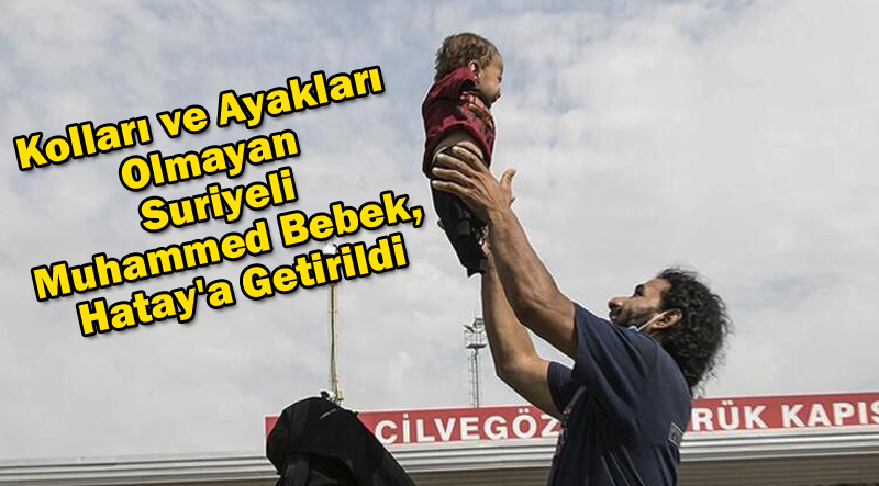 Kolları ve Ayakları Olmayan Suriyeli Muhammed Bebek, Hatay’a Getirildi