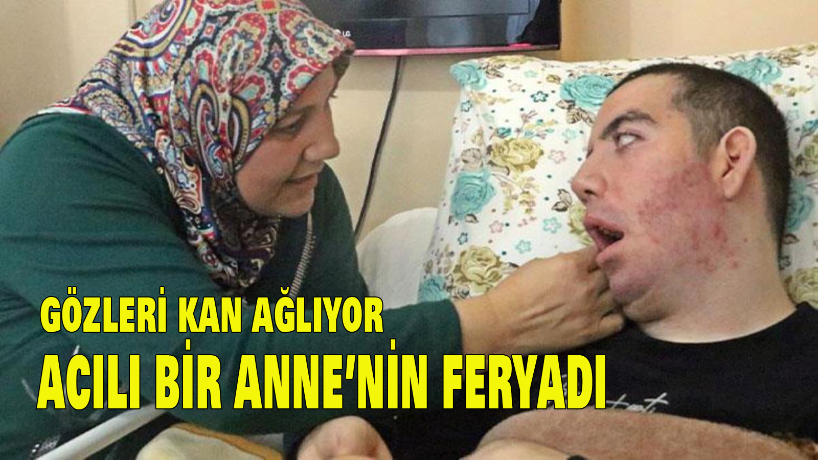10 yıldır göz kapakları kapanmadan yatağa mahkum