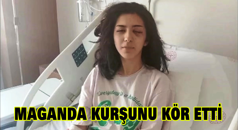 Maganda kurşunu kör etti
