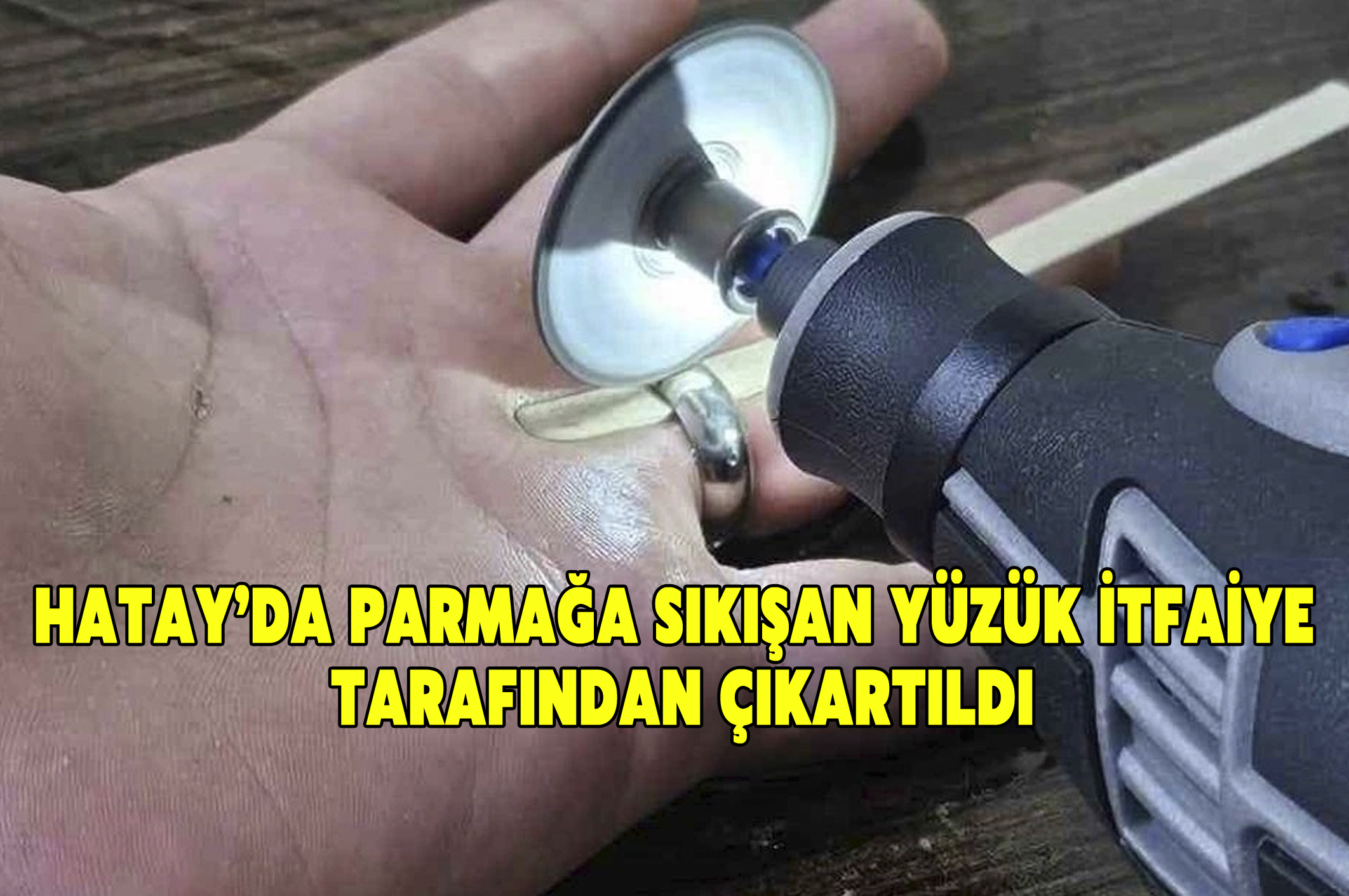 Hatay’da Parmağa Sıkışan Yüzük İtfaiye Tarafından Çıkartıldı