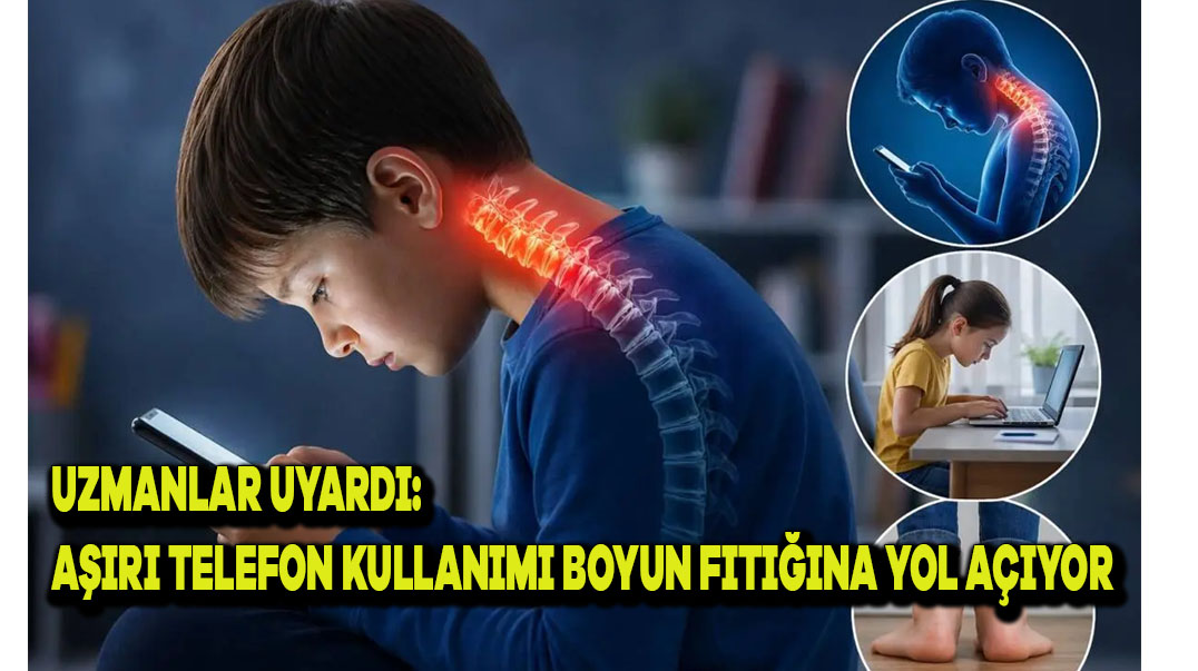Uzmanlar Uyardı: Aşırı Telefon Kullanımı Boyun Fıtığına Yol Açıyor